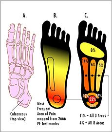 PF Pain Areas