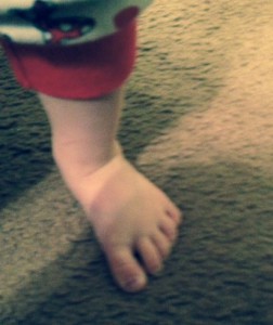 20 Month Baby Foot