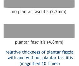 plantar fascia thickness